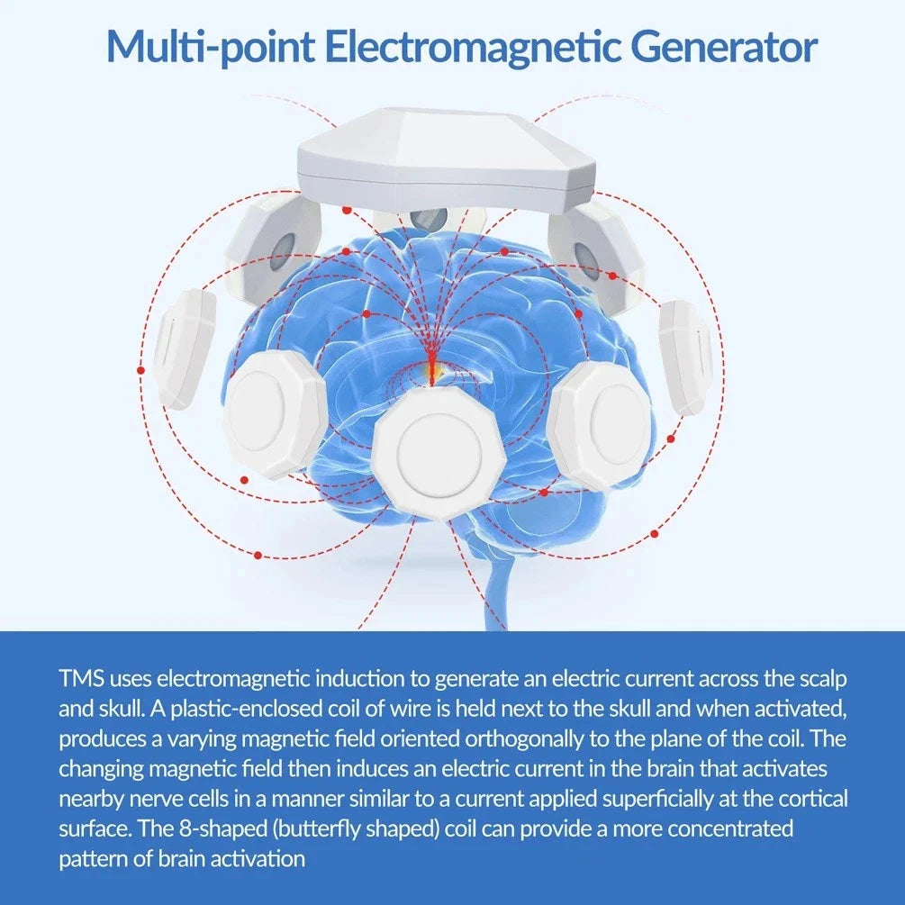 MindCalm Neuro Wellness Device